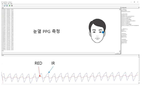 PPG+EOG 센서 모듈의 눈옆에서의 PPG 측정 결과