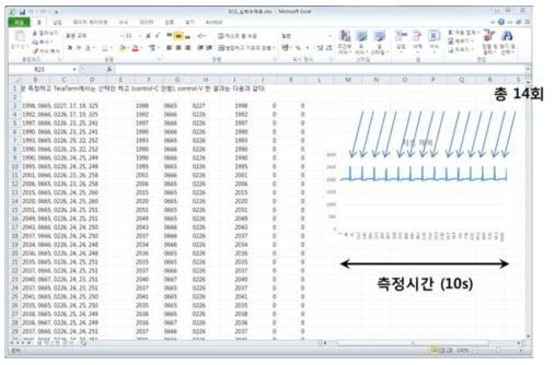 Microsoft Excel에서 분석되는 ECG 데이터