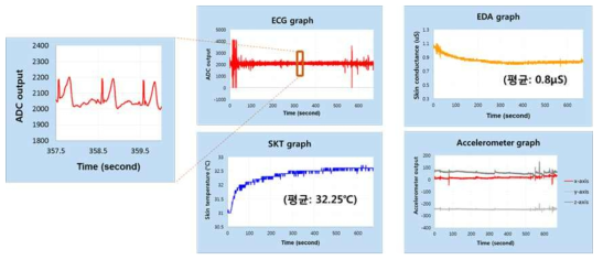 (ECG 복합 센서 모듈의 시험 I) 그래프로 표현된 수집 데이터