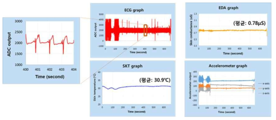 (ECG 복합 센서 모듈의 시험 III) 그래프로 표현된 수집 데이터