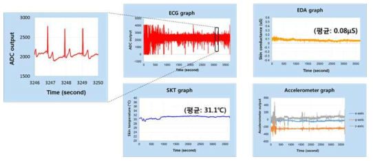 (ECG 복합 센서 모듈의 시험 IV) 그래프로 표현된 수집 데이터