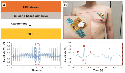 (a) 실리콘 접착제를 이용한 유연 ECG 디바이스 피부부착 개념도, (b) 유연 ECG 디바이스 피부부착 광학 이미지, (c) ECG 시그널 및 (d) 확대도