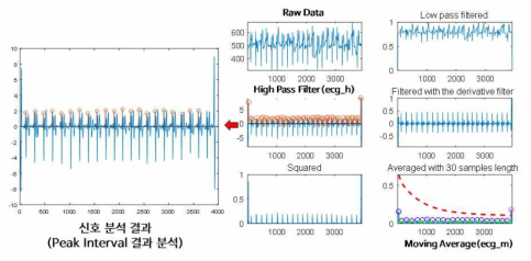 ECG 신호 분석 결과