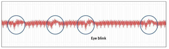 EEG Raw data 기반 눈 깜빡임 테스트 결과