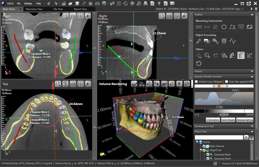 개발 SW에서 3차원 측량 도구가 적용된 2D 및 3D 가시화 화면