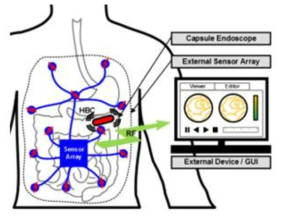 HBC를 사용한 캡슐 내시경의 위치 추적 모식도