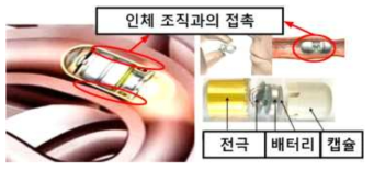 캡슐 내시경의 전극과 인터페이스 분석 예시