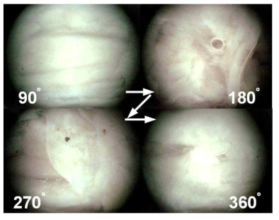 각도에 따라 촬영된 장기의 내시경 화면