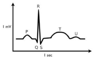 ECG 신호를 체표면의 특정 부위에 전극을 부착하고 전위를 유도하여 기록