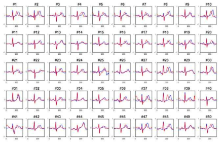 운동 후 심전도 파형 변화 모습 (206명 중 50명 예시, 파랑: 운동 전, 빨강: 운동 후)