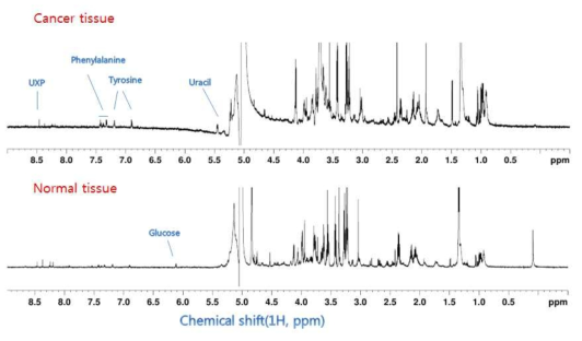 대장의 정상 및 종양조직에서 700 MHz HR-MAS 1H NMR 스펙트럼으로 부터 얻어진 전형적인 대사산물