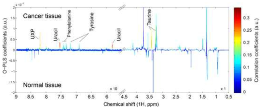 700 MHz 고분해능 마법 각 방사 핵 자기 공명 (HR-MAS NMR) 분광학에 의하여 결장(colon)의 정상조직(n=18)과 종양조직(n=18)에서 측정되어진 대사산물들. UXP, uridine di-or tri-phosphate