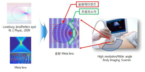 초음파용 음향 Luneburg 메타 렌즈의 개념도 및 응용 예