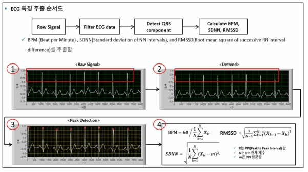 심전도(ECG) 파의 특징 추출 과정을 나타낸 그림