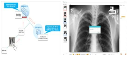 딥러닝시스템 포함 빅데이터 클러스트와 X-Ray 라벨링 SW