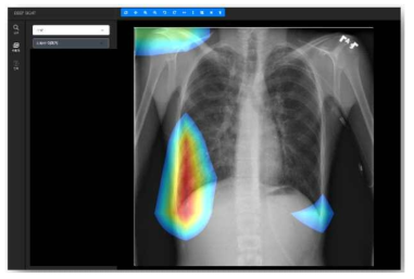 X-Ray 히트맵 표시 예시