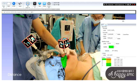 환자 수술 부위에 가상수술 시뮬레이션이 AR로 보여지는 모습