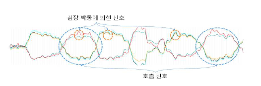 심박 호흡 분리 기법