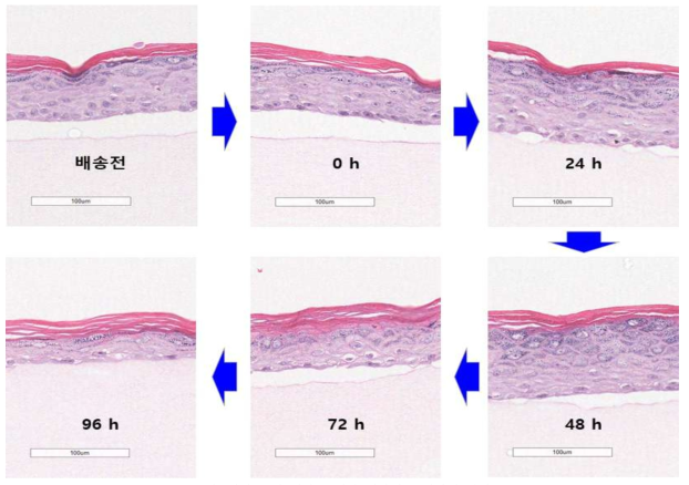 저장 수명 평가를 위한 시간별 조직학적 변화