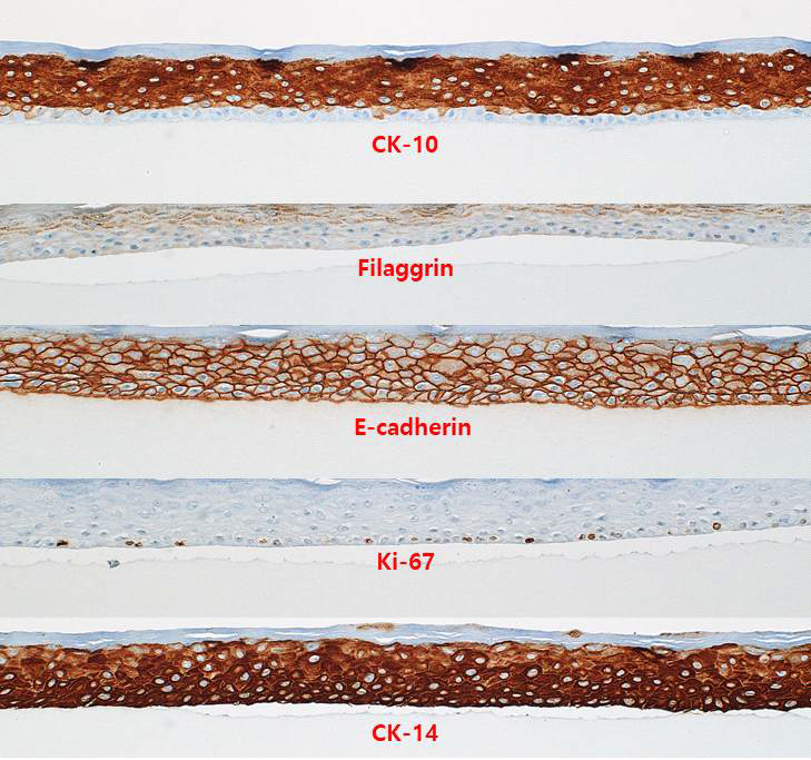 TNR-EPI 조직의 표피 분화 마커에 대한 면역조직화학염색