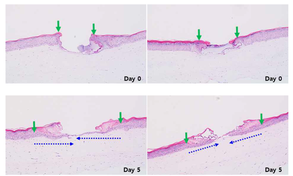 TNR 조직의 Burn wounds 에서의 Day0 및 Day5 조직의 형태학적 평가 및 Keratinocyte migration 길이 측정