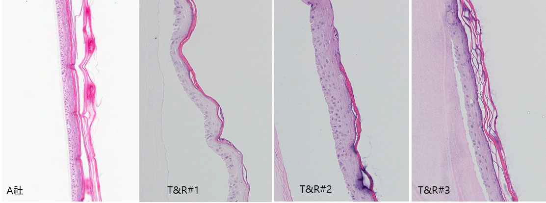 상용화 모델(좌)과 비교했을 때 표피층의 두께가 큰 차이를 보이지 않았고, 정상 표피층이 모두 형성되었음. 그러나 여전히 각질층의 분화가 덜 이루어져 있고, 일부 샘플에서 표면이 전체적으로 고르지 못하는 현상 발생