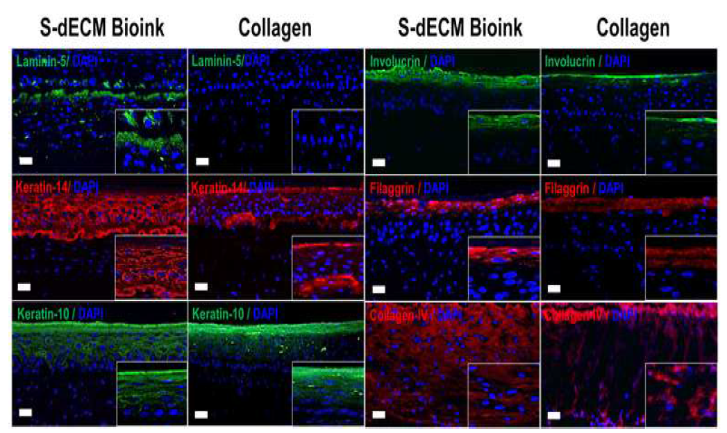 Collagen, Skin-dECM를 이용한 모델에서 인간피부에서 발현되는 단백질 발현 비교
