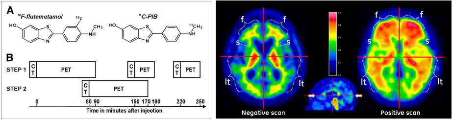 GE사에 개발한 치매진단 영상바이오마커 [18F]Flutemetamol (FDA승인, 2014년)