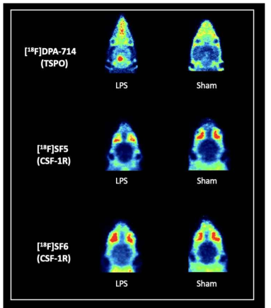신경염증 영상용 신규 방사성의약품 2종의 PET 영상