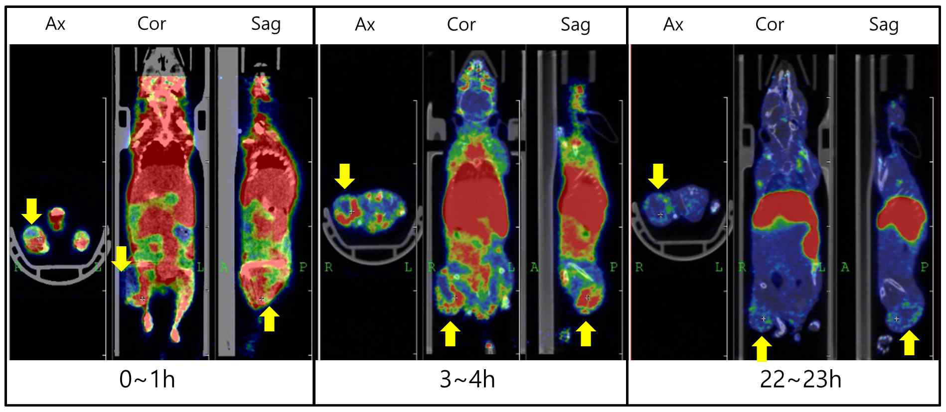 64Cu-TDAP의 전신 PET 영상. 노란색 화살표:종양부위
