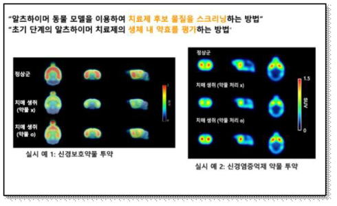 치매 치료제에 대한 치료 반응 모니터링