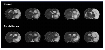 중뇌종맥 폐쇄 뇌졸중 모델에서 재활운동 전후의 확산강조 영상