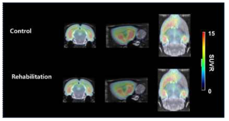 중뇌종맥 폐쇄 뇌졸중 모델에서 재활운동 전후의 글루타메이트 PET