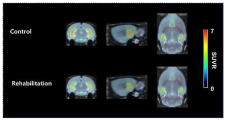 중뇌종맥 폐쇄 뇌졸중 모델에서 재활운동 전후의 세로토닌 PET