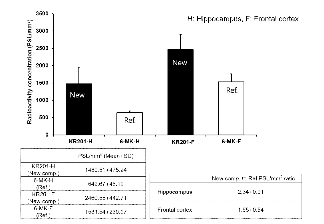 해마와 전두엽에서의 125I-MK와 125I-KR201 화합물 방사성 농도 비교