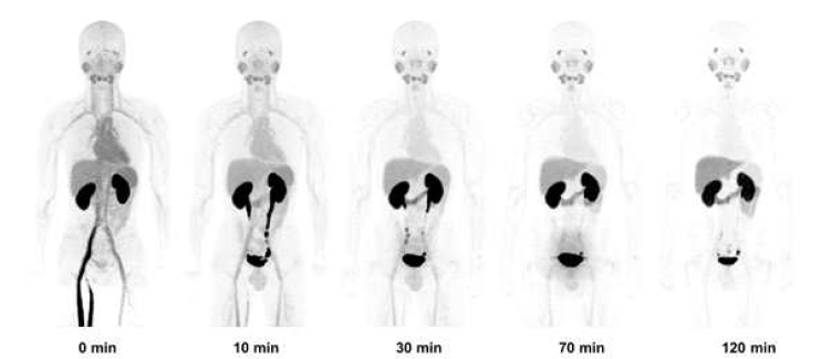 정상 성인 남자에서 [F-18]Florastamin 투여 이후 시간에 따른 PET 영상 변화