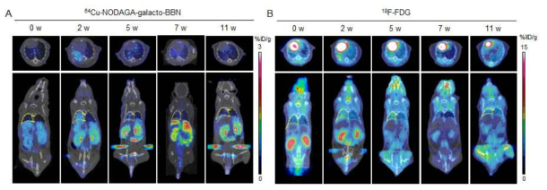방사선 유도 폐 섬유화 동물 모델의 PET/CT영상