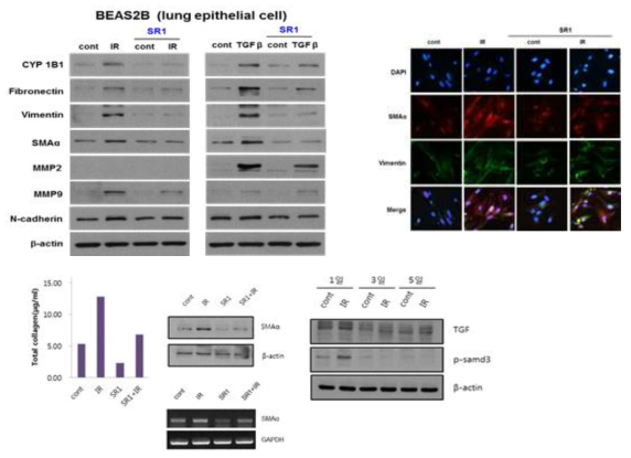 StemRegenin 1 (SR1) 이 폐상피세포와 폐섬유아세포의 섬유화를 억제