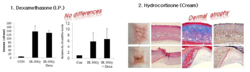 Glucocorticoids 적용에 의한 방사선 피부염 치료효과 및 부작용 평가