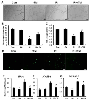 방사선 직장염 모델에서의 pravastatin 치료 효과: HUVECs에서의 방사선에 의한 endothelial dysfunction과 thrombomodulin에 의한 회복효과