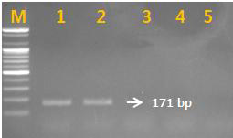 PCR 산물에 대한 젤 이미지. lane M: 100 bp DNA ladder; lane 1-2 : 용안(D.longan) ; Iane 3-4: 여지(L. shinensis) Iane 5: NTC(No Template Control)