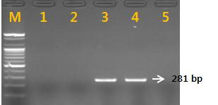 PCR 산물에 대한 젤 이미지. lane M: 100 bp DNA ladder; lane 1-2 : 용안(D.longan) ; Iane 3-4: 여지(L. shinensis) Iane 5: NTC(No Template Control)