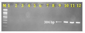 PCR 산물에 대한 젤 이미지. lane M: 100 bp DNA ladder; ; lane 1-3: 하수오(P. multiflorum); lane 4-6: 나도하수오(P. ciliinerve); lane 7-9: 익요(P. giraldii) ; lane 10-12: 둥근마(D. bulbifera)