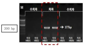 PCR 산물에 대한 젤 이미지. M 100 bp DNA ladder lane 1-2, 5-7 : 수치자 (G. jasminoides var. grandiflora) ;lane 3-4 : 치자(G. jasminoides)