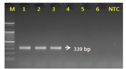 PCR 산물에 대한 젤 이미지. lane M: 100 bp DNA ladder; lane 1-3: 백수오(Cyanchum wilfordii);lane 4-5: 이엽우피소(Cyanchum auriculatum); 6 lane: 절관우피소(C. boudieri) lane 7 : NTC(No Template Control)