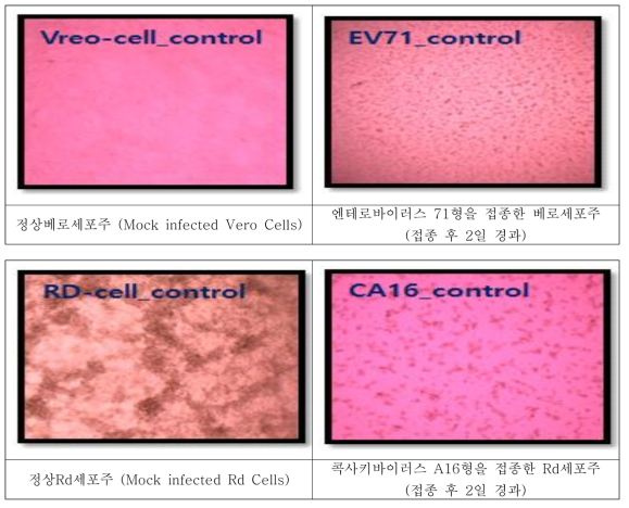 엔테로바이러스를 접종한 세포주에서 관찰되는 세포변성효과 (접종전/접종후)