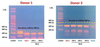 다양한 공여자 유래 줄기세포 배양액 내 mycoplasma test 평가