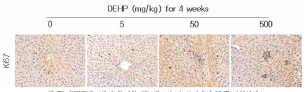 DEHP를 4주간 투여한 SD 랫드의 간 조직에서 Ki67 면역염색