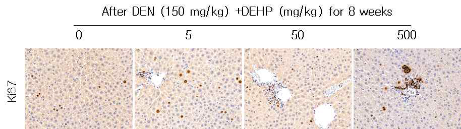 DEN+DEHP를 8주간 투여한 SD 랫드의 간 조직에서 Ki67 면역염색