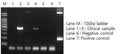 패류 crAssphage conventional PCR 전기영동 결과